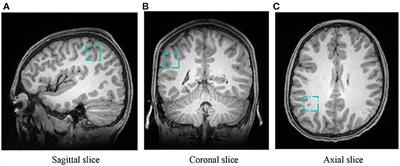 An MRI Study on Effects of Math Education on Brain Development Using Multi-Instance Contrastive Learning